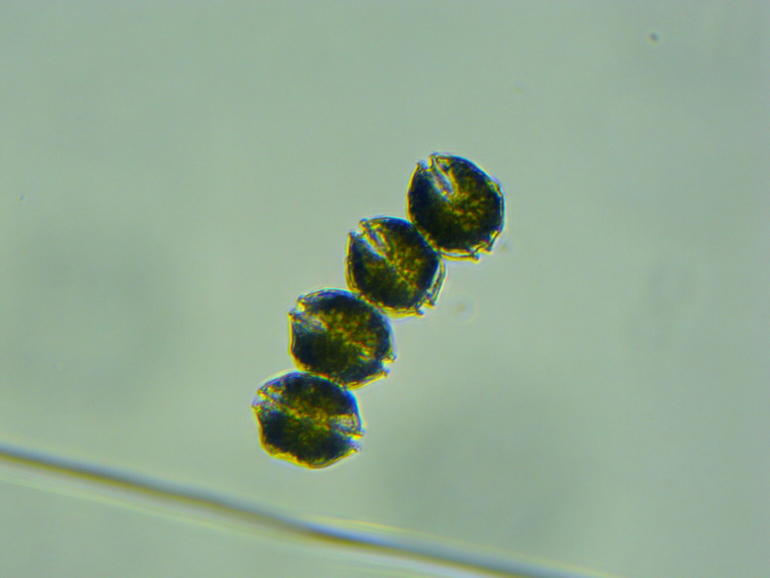 Kachemak Bay, other Alaska scientists concerned about  harmful algae blooms